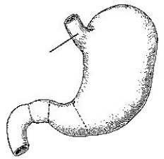 <strong>The area identified in the figure below is the: </strong> A) fundus. B) angular notch. C) cardiac antrum. D) lesser curvature.
