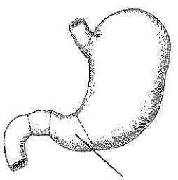 <strong>The part of the stomach identified in the figure below is the: </strong> A) greater curvature. B) pyloric antrum. C) pyloric canal. D) pyloric sphincter.