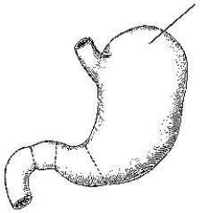 <strong>The area identified in the figure below is the: </strong> A) fundus. B) body. C) cardiac antrum. D) greater curvature.