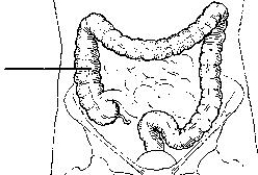 <strong>The area of the colon identified in the figure below is the: </strong> A) left colic flexure. B) right colic flexure. C) ascending colon. D) descending colon.