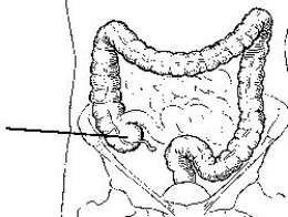 <strong>The area of the colon identified in the figure below is the: </strong> A) cecum. B) ileum. C) sigmoid. D) rectum.