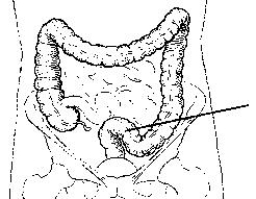 <strong>The area of the colon identified in the figure below is the: </strong> A) cecum. B) ileum. C) rectum. D) sigmoid.