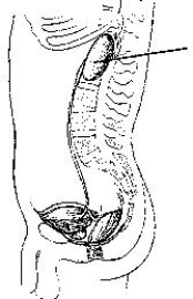 <strong>The organ identified in the figure below is the: </strong> A) spleen. B) liver. C) left kidney. D) right kidney.