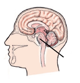 <strong>What part of the brain is indicated by the line in the diagram? </strong> A) Pons B) Cerebrum C) Cerebellum D) Brainstem