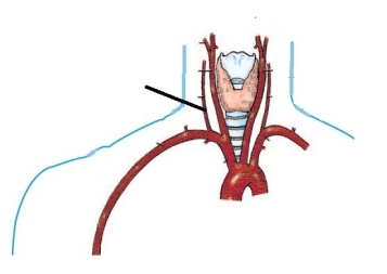 <strong>The artery identified in the figure below is the: </strong> A) left vertebral. B) right vertebral. C) right common carotid. D) left internal carotid.