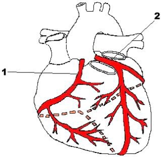 <strong>The artery identified in the figure below labeled 1 is the _____ artery. </strong> A) left coronary B) right coronary C) circumflex D) obtuse marginal