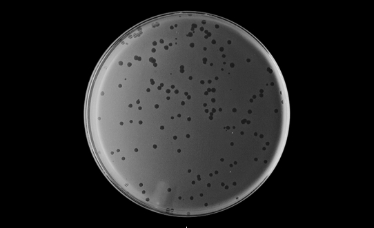 <strong>When mixed with their host bacterium and plated on solid agar, lytic phage will form clear areas in the bacterial growth. What are these clear areas called? </strong> A) plaques B) zones of inhibition C) assays D) titers E) halos