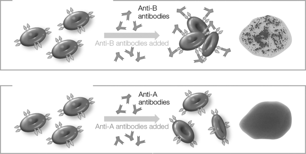 <strong>According to the agglutination tests pictured below, what is the blood type of the sample being tested? </strong> A) A B) B C) O D) AB E) Could be either A or B