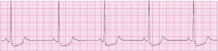 Identify the following rhythm (lead II): ____________________