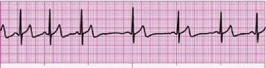 Identify the following rhythm (lead II): ____________________