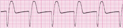 Identify the following rhythm (lead II): ____________________  <div style=padding-top: 35px> 