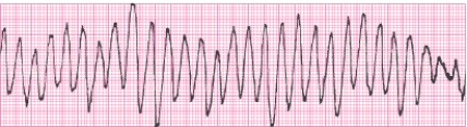 Identify the following rhythm (lead II): ____________________  <div style=padding-top: 35px> 