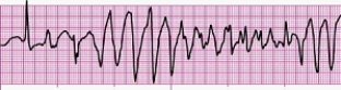 Identify the following rhythm (lead II): ____________________  <div style=padding-top: 35px> 