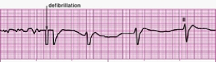 Identify the following rhythm (lead II): ____________________  <div style=padding-top: 35px> 