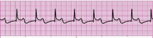 Identify the following rhythm (lead II): ____________________  <div style=padding-top: 35px> 