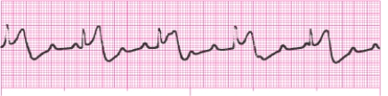 Identify the following rhythm: _________________________
