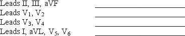 Indicate the heart surface viewed by each of the following: