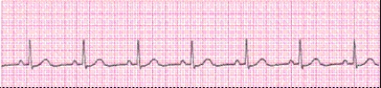 Identify the following rhythm (lead II): ____________________