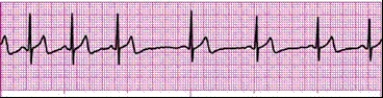 Identify the following rhythm (lead II): ____________________