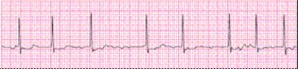 Identify the following rhythm (lead II): ____________________