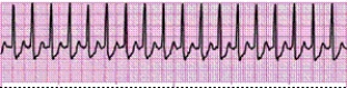 Identify the following rhythm (lead II): ____________________