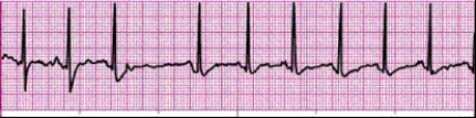 Identify the following rhythm (lead II): ____________________