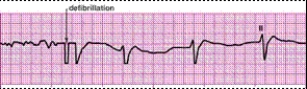Identify the following rhythm (lead II): ____________________  <div style=padding-top: 35px> 
