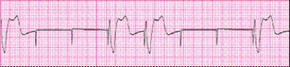 Identify the following rhythm: _________________________