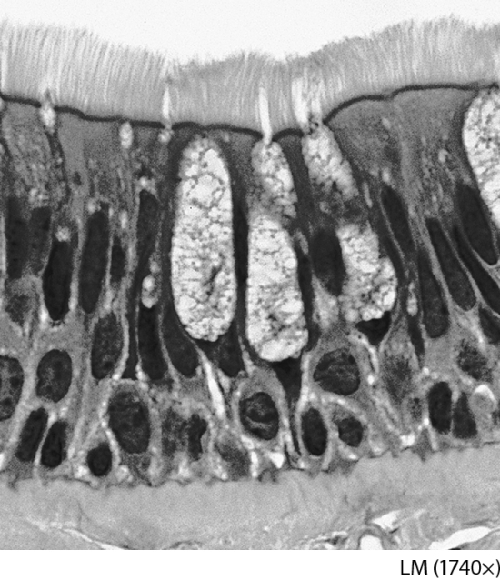 <strong>The tissue pictured in this figure is: </strong> A) composed of a single layer of columnar cells appearing stratified. B) composed of two layers of columnar cells. C) composed of multiple layers of columnar cells. D) composed of two layers of cuboidal cells.