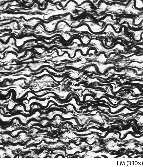 <strong>What fibers are common in this tissue? </strong> A) reticular only B) collagen only C) both elastic and some reticular D) both elastic and some collagen
