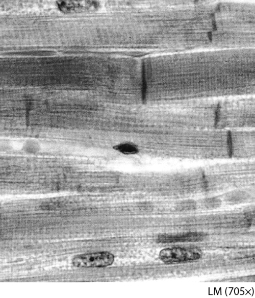 <strong>Name this tissue. </strong> A) cardiac muscle tissue B) smooth muscle tissue C) dense irregular connective tissue D) skeletal muscle tissue