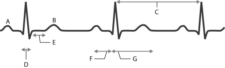 Match the following with the waves, segments, or intervals on the electrocardiogram (ECG). -Identify the interval during which the ventricles are undergoing action potentials.