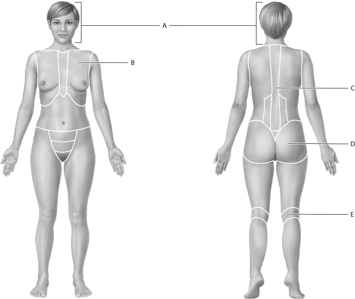 Match the following with the correct regional anatomical term. Identify the cephalic region.
