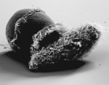 The organisms in the photo belong to the group  
