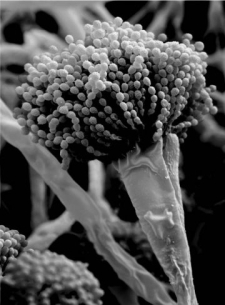 <strong>  This image was most likely produced by a microscope.</strong> A) scanning electron B) bright-field C) confocal D) transmission electron E) dark-field <div style=padding-top: 35px> 