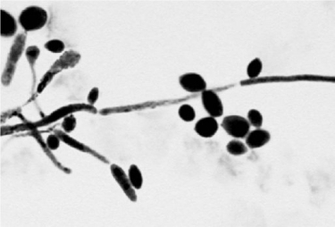 <strong>  The presence of the specimen shown in the figure in a vaginal discharge is evidence of infection with</strong> A) Trichomonas vaginalis. B) Treponema palladium. C) Chlamydia trachomatis. D) Candida albicans. E) Neisseria gonorrhoeae. <div style=padding-top: 35px> 
