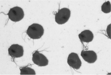 <strong>  Observation of the microbes shown in the figure from a vaginal discharge specimen is diagnostic for</strong> A) syphilis. B) gonorrhea. C) trachoma. D) trichomoniasis. E) Chlamydia infection. <div style=padding-top: 35px> 
