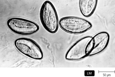 <strong>  Observation of the specimens in the figure is diagnostic for</strong> A) Enterobius vermicularis. B) Anisakis simplex. C) Cryptosporidium parvum. D) Giardia intestinalis. E) Taenia solium. <div style=padding-top: 35px> 