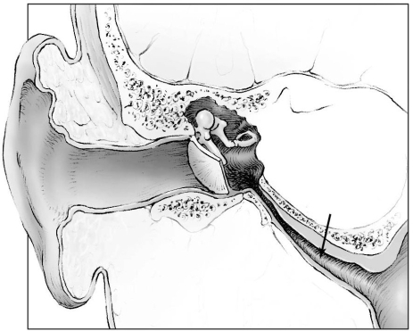 <strong>  The structure indicated by the arrow connects the middle ear to what part of the respiratory system?</strong> A) pharynx B) larynx C) nasal cavity D) sinuses E) trachea <div style=padding-top: 35px> 