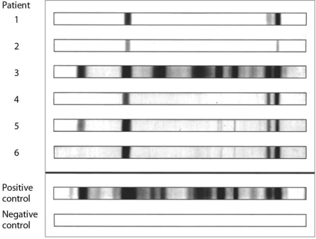 <strong>  The diagnostic assay represented in the figure is useful when</strong> A) verifying the presence of a pathogen. B) determining blood type. C) an immune response may result in production of a mix of antibodies against complex antigens. D) determining the concentration of antibodies in sera. E) an immune response is too weak to be detected by other means. <div style=padding-top: 35px> 