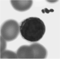 <strong> What type of white blood cell is shown in Figure 15 -1?</strong> A) eosinophil B) lymphocyte C) monocyte D) neutrophil E) basophil