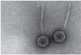 The virions shown in the figure have a (polyhedral/helical/complex) capsid.