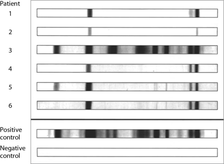 <strong>  For what is the assay shown here used?</strong> A) detecting antibodies against a complex mix of antigens B) detecting neutralizing antibodies C) blood typing D) determining the concentration of antibodies E) verifying infection with a virus <div style=padding-top: 35px> 