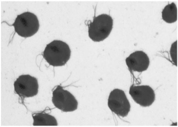 <strong> Observation of the microbes shown in the figure from a vaginal discharge specimen is diagnostic for</strong> A) Chlamydia infection. B) gonorrhea. C) trichomoniasis. D) trachoma. E) syphilis.