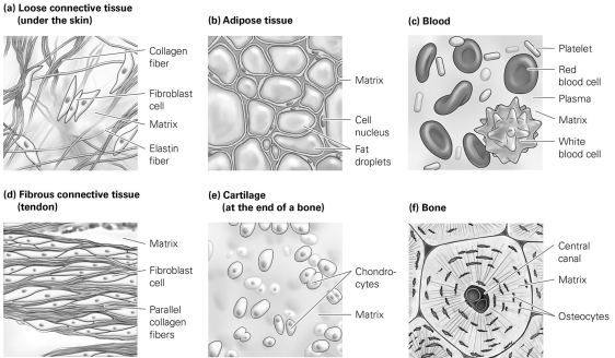 <strong>  Which connective tissue type has collagen fibers arranged parallel with one another in a very organized, layered fashion?</strong> A) bone B) blood C) adipose tissue D) fibrous connective tissue <div style=padding-top: 35px> 