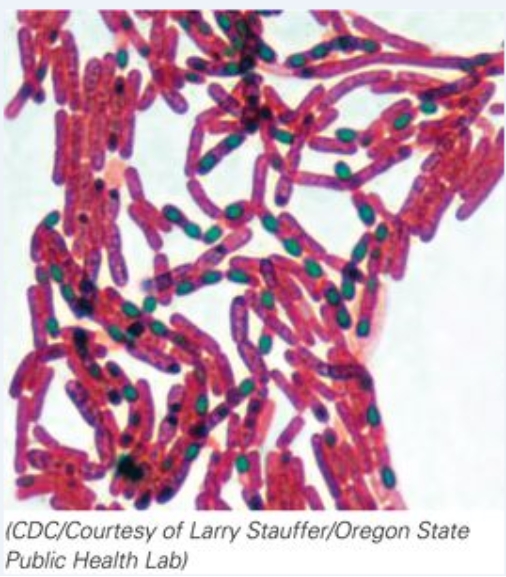 <strong>Which of the following stains has been used on this microorganism? </strong> A)Flagellar stain B)Capsule stain C)Endospore stain D)No stain