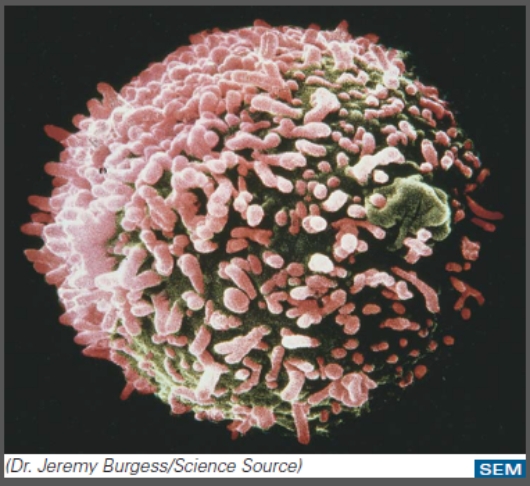 <strong>This cell is the result of fusing a: </strong> A)cancer cell and a plasma cell. B)virus and a bacterium C)cancer cell and a virus D)plasma cell and a virus