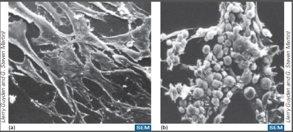 <strong>What type of effect is occurring with these cells infected by RSV? </strong> A)Cytopathic effect B)CPE C)Nuclear effect D)Cytoplasmic effect E)Both Cytopathic effect and CPE are correct