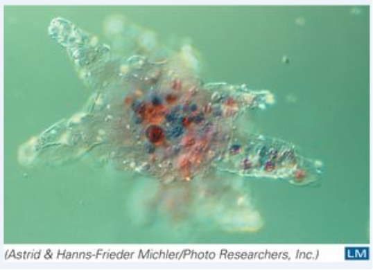 <strong>This organism moves by: </strong> A)flagella B)cilia C)pseudopodia D)cannot move