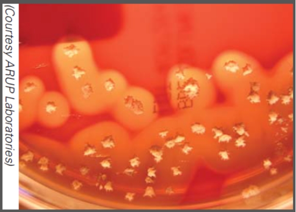 <strong>What type of toxin is illustrated in this image?  </strong> A)Endotoxin B)Exotoxin C)Enterotoxin D)Neurotoxin <div style=padding-top: 35px> 